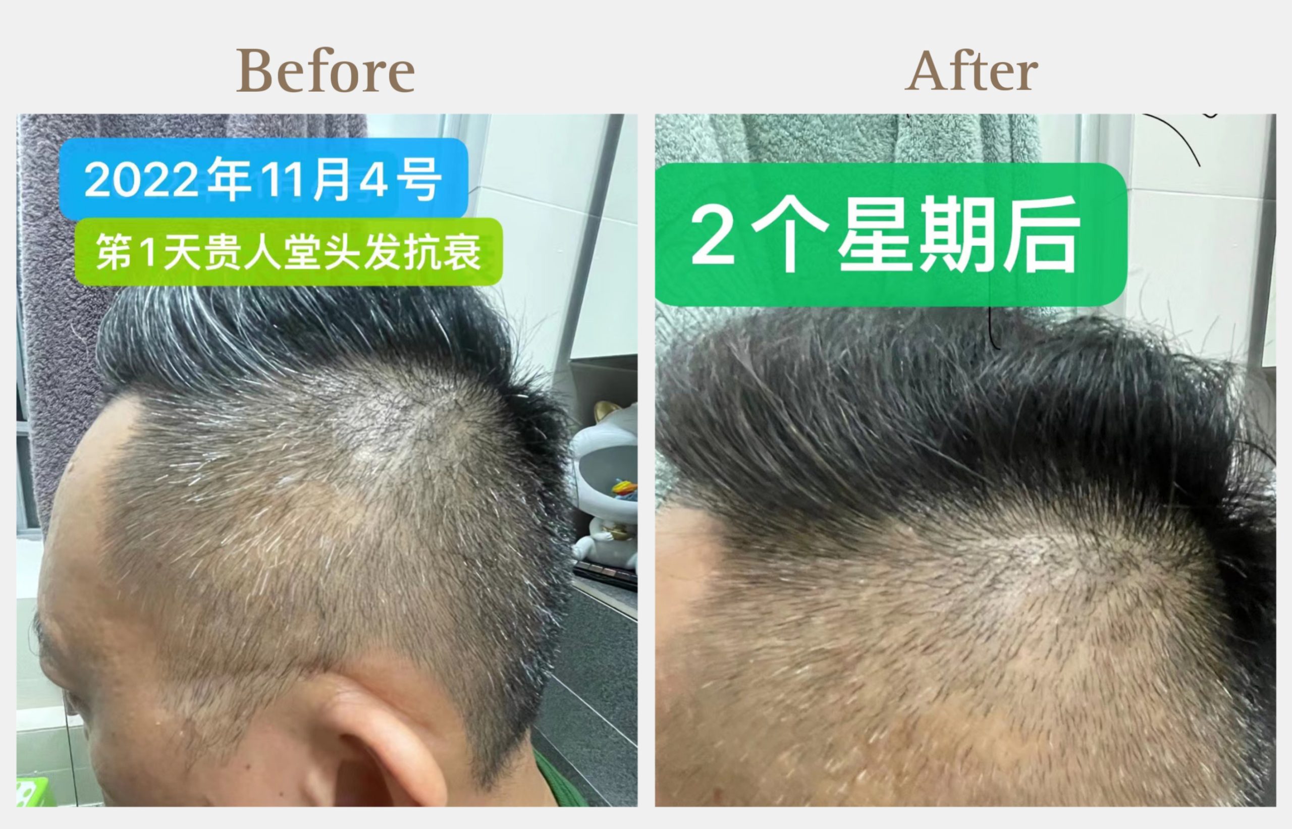 before-and-after-white-hair-transformation-therapy