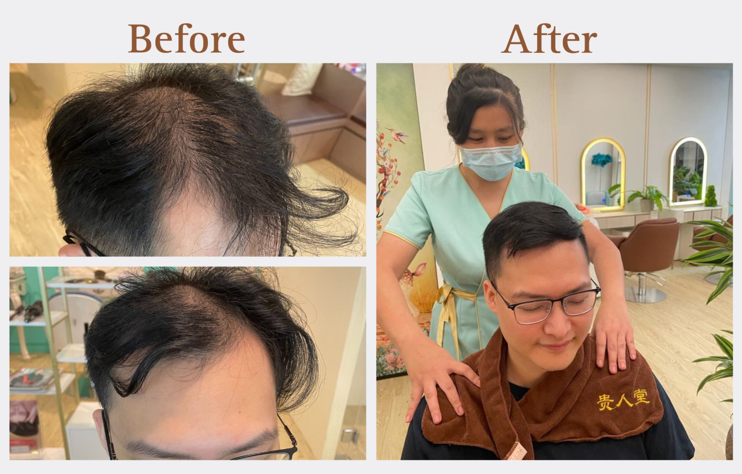 hair-growth-regeneration-therapy-before-and-after